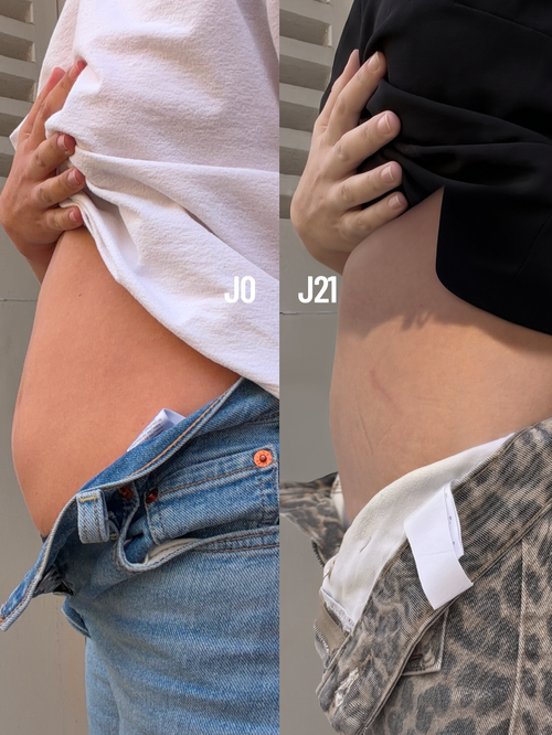 WE WANT… A NAIADE-FLAT TUMMY